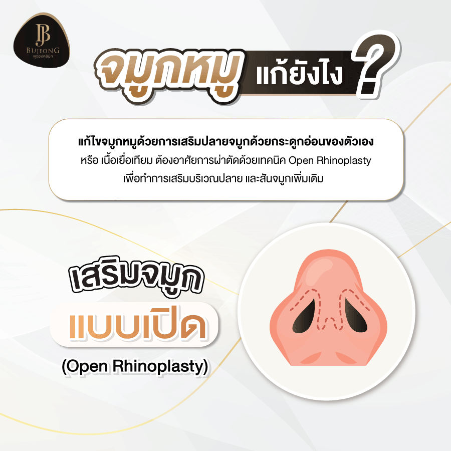 จมูกหมู แก้ยังไง